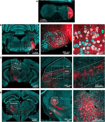Trigeminal Contributions to the Dorsal Cochlear Nucleus in Mouse